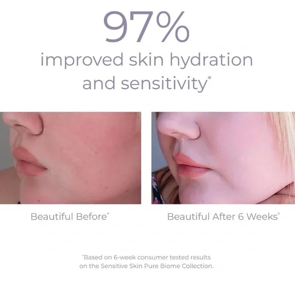 $10❤️‍🔥 LAST 1! Derma E Pure Biome Balancing Serum 💧 NEW IN BOX Cica Redness - Picture 4 of 7